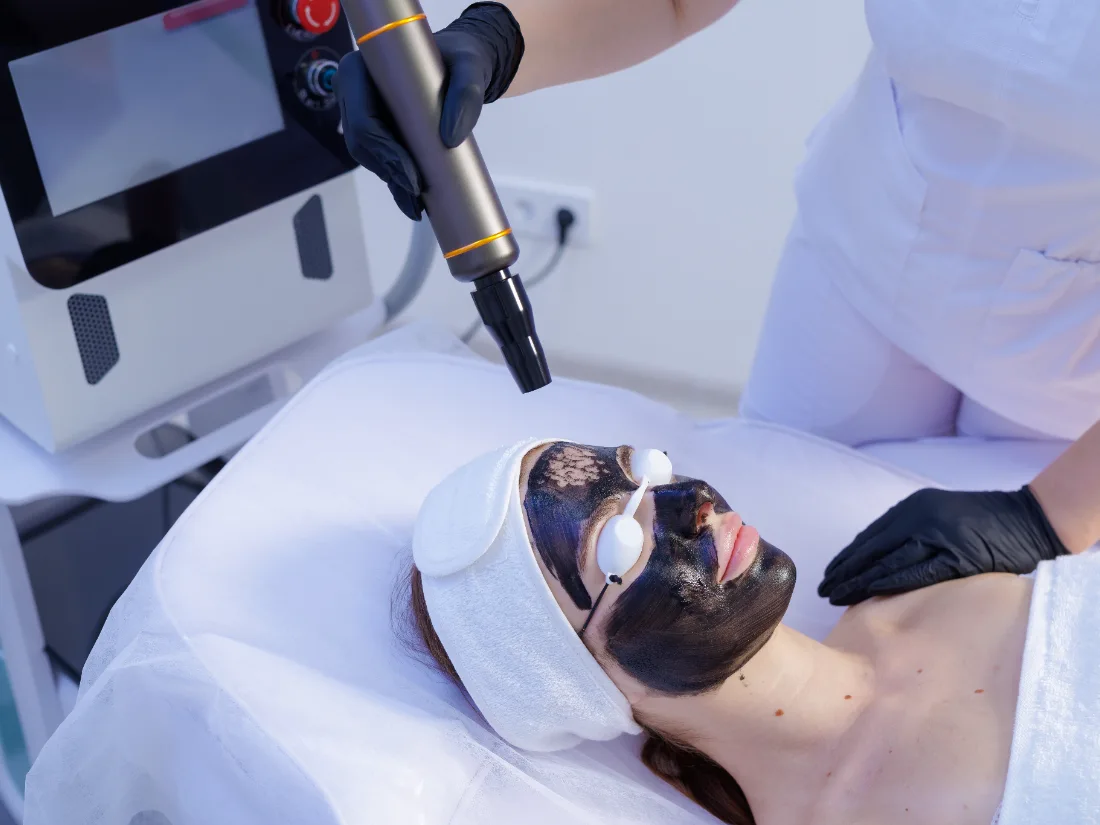 Carbon laser at LetMein Beauty