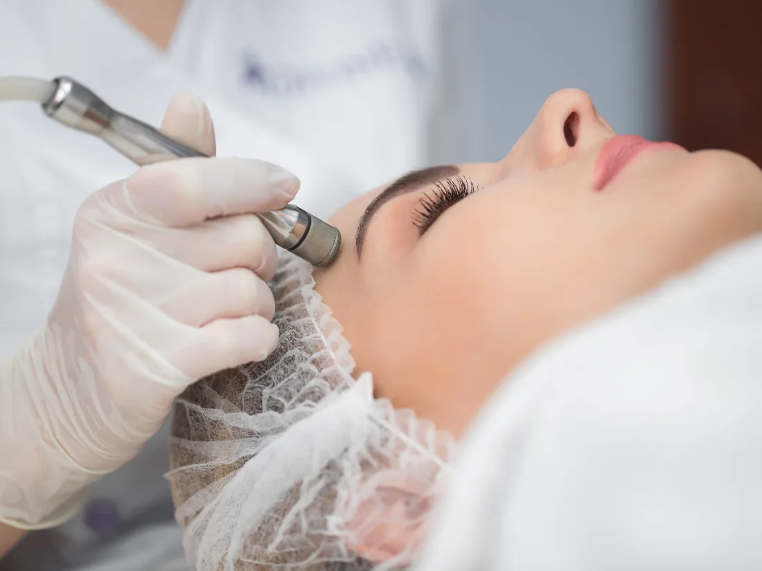 Diamond peel at LetMein Beauty