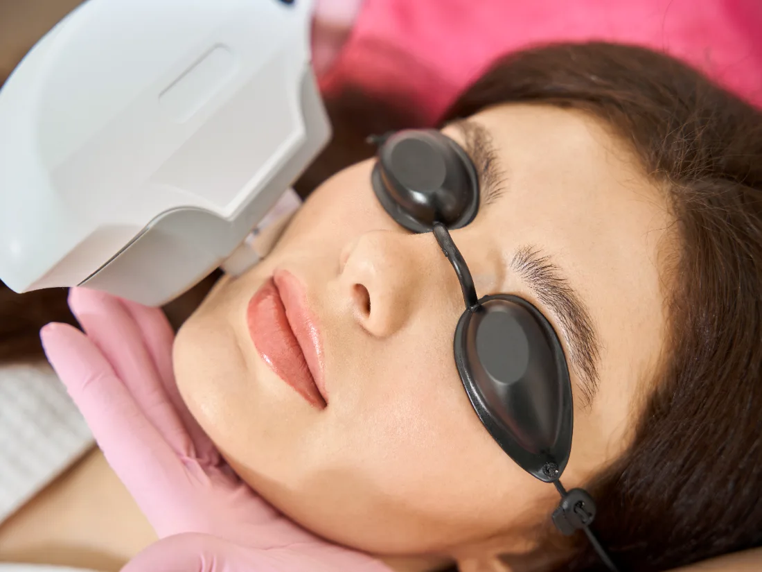 IPL Laser — Hair Removal & Whitening at LetMein Beauty, Angeles City