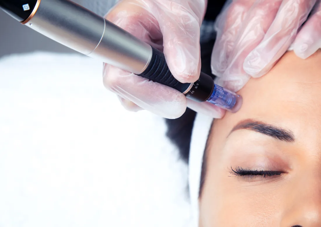 Stem Cell Infusion Facial at LetMein Beauty, Angeles City
